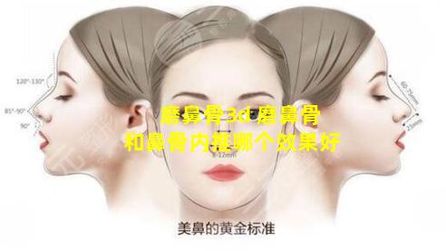 磨鼻骨3d 磨鼻骨和鼻骨内推哪个效果好